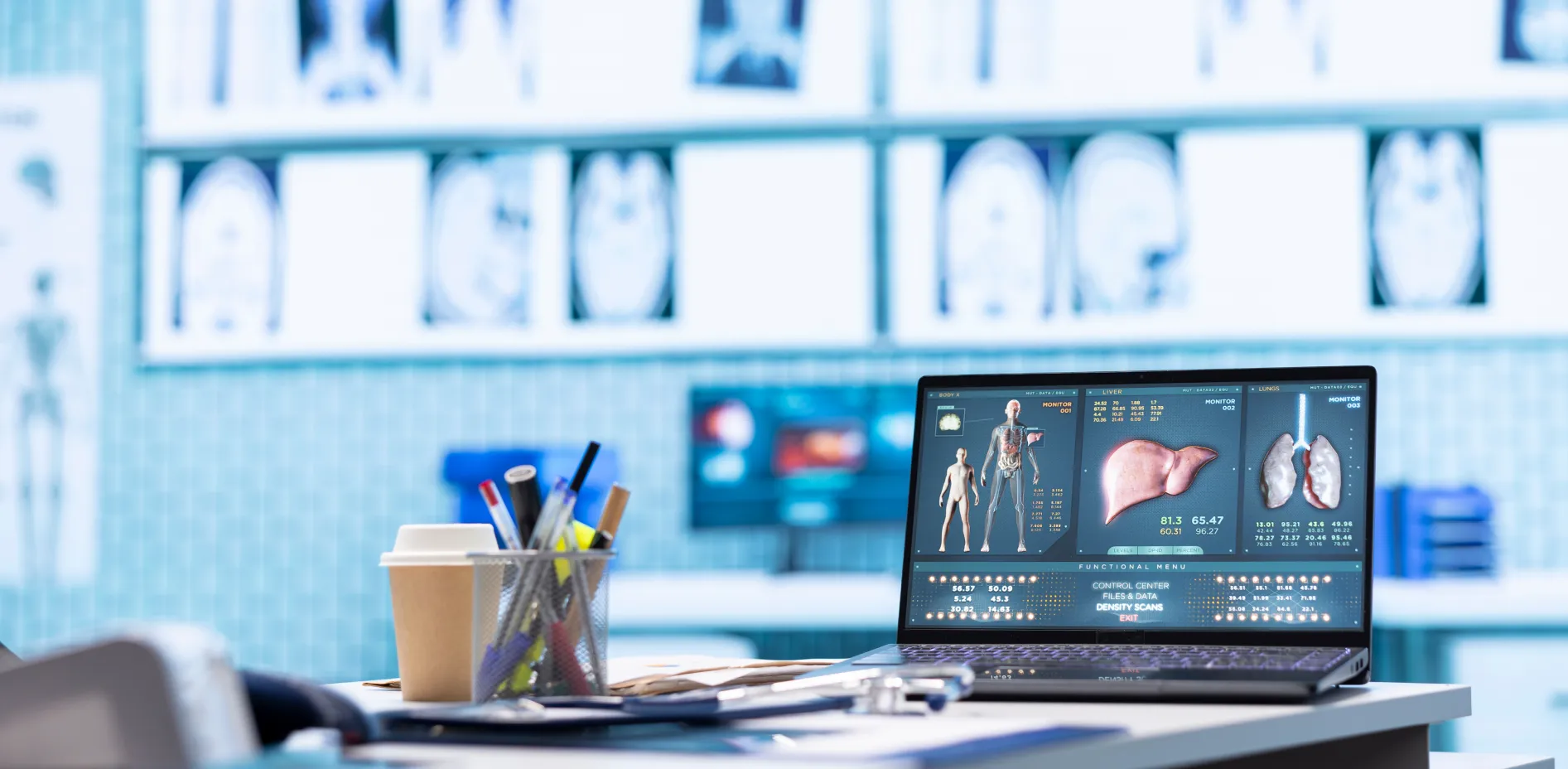 Radiology workspace with a laptop showing a digital body scan